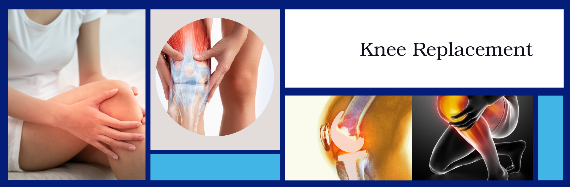 Mark Beasley Knee Replacement Resources