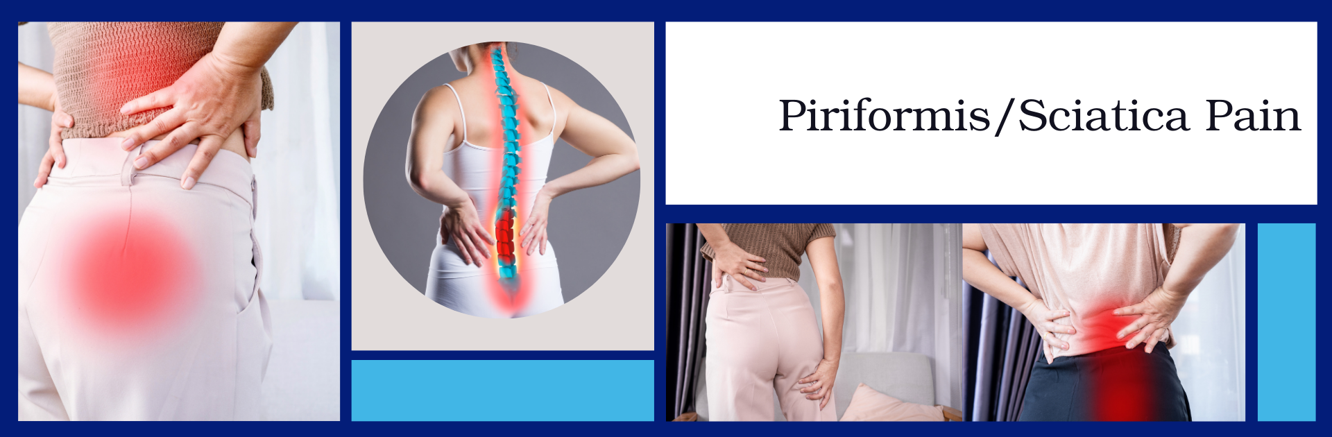 Mark Beasley Piriformis Sciatica Resources