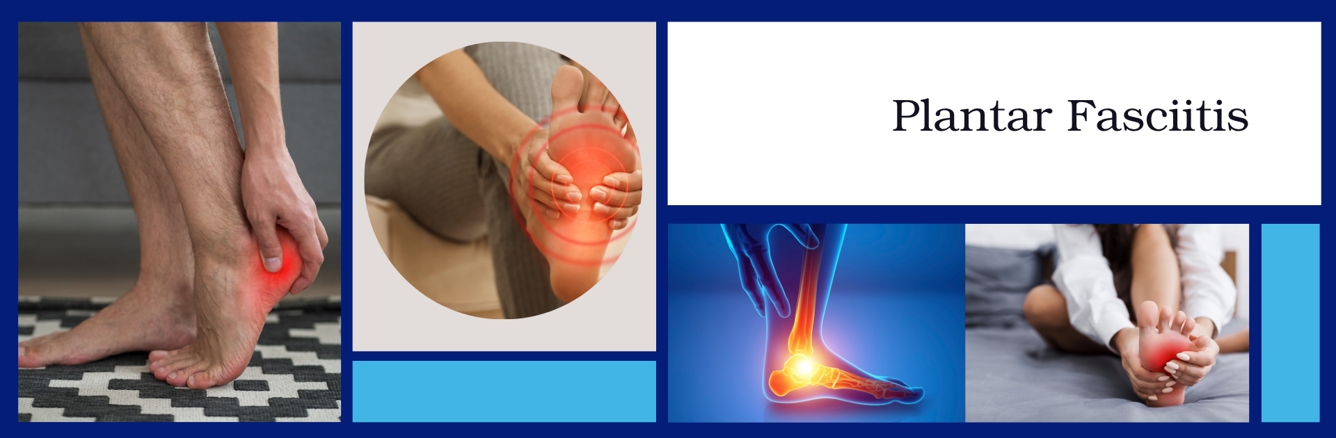 Plantar Fasciitis at Mark Beasley Coaching